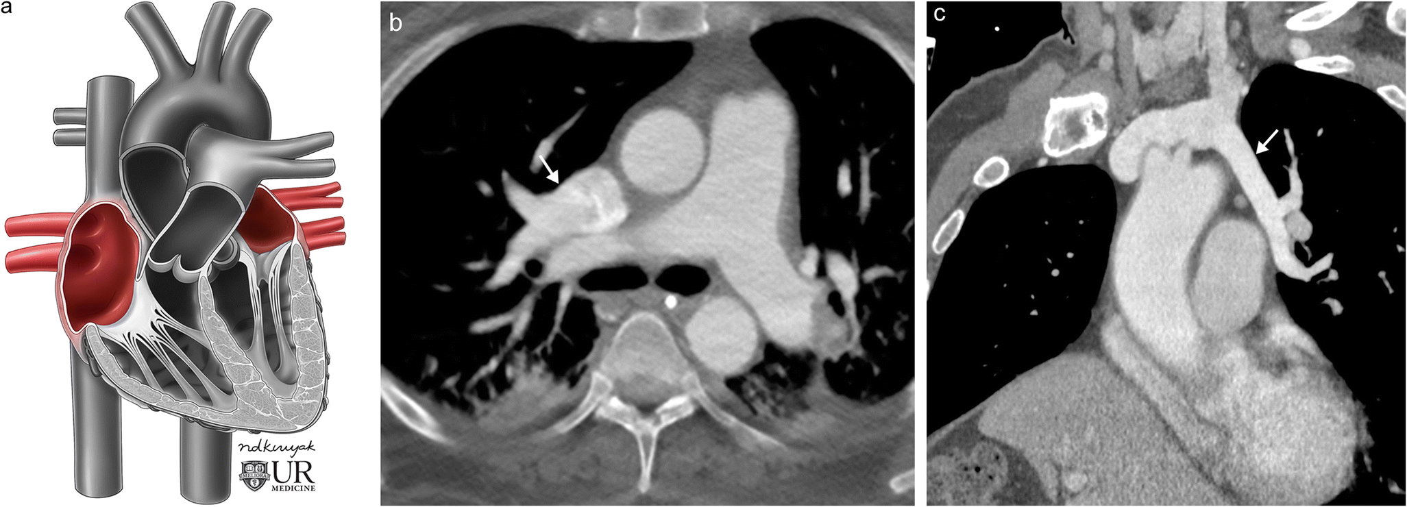 Fig. 12