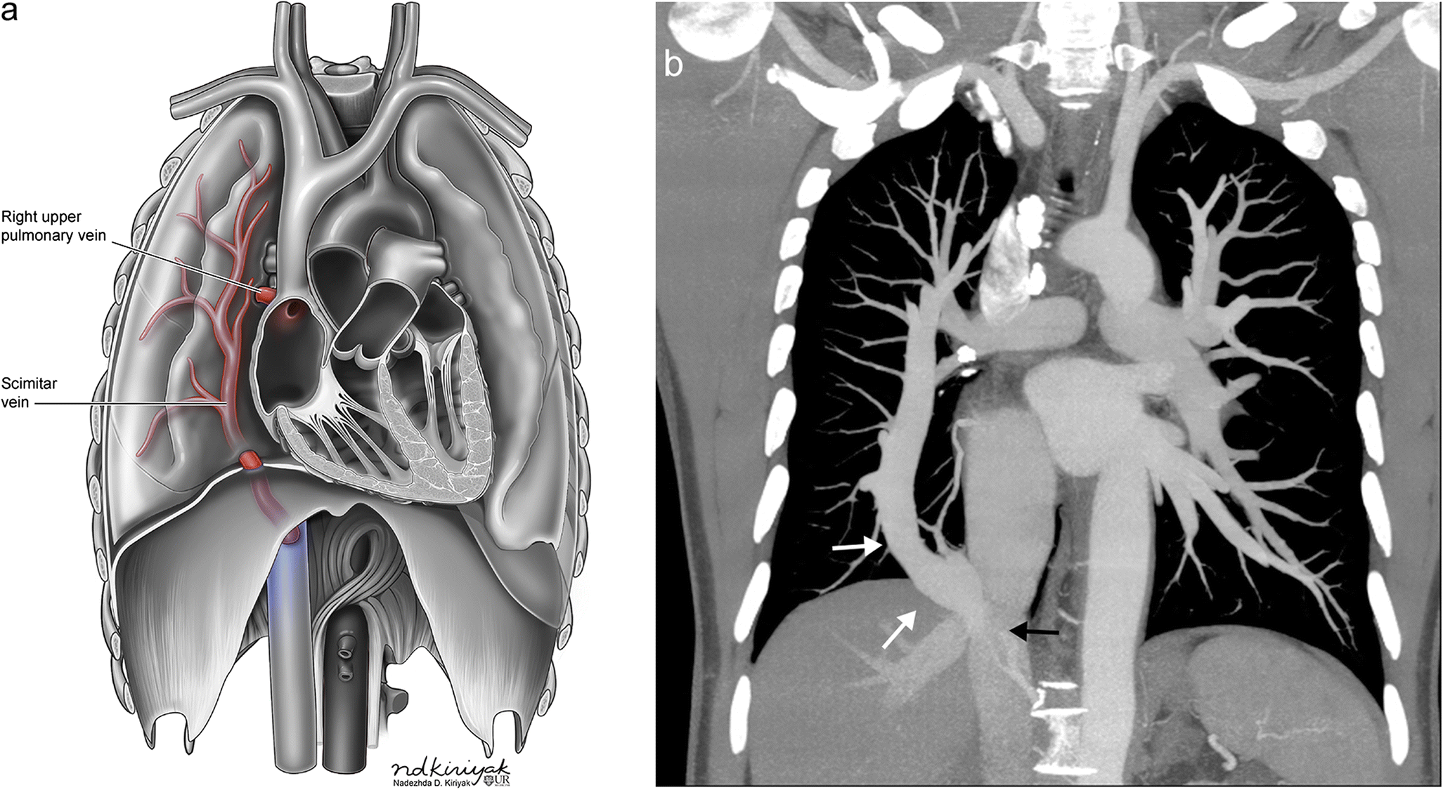 Fig. 13