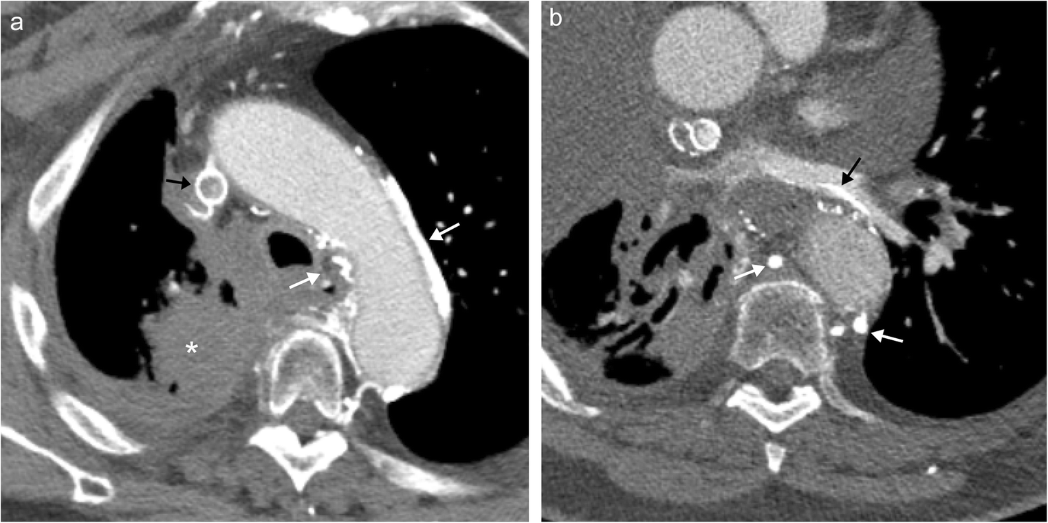 Fig. 16