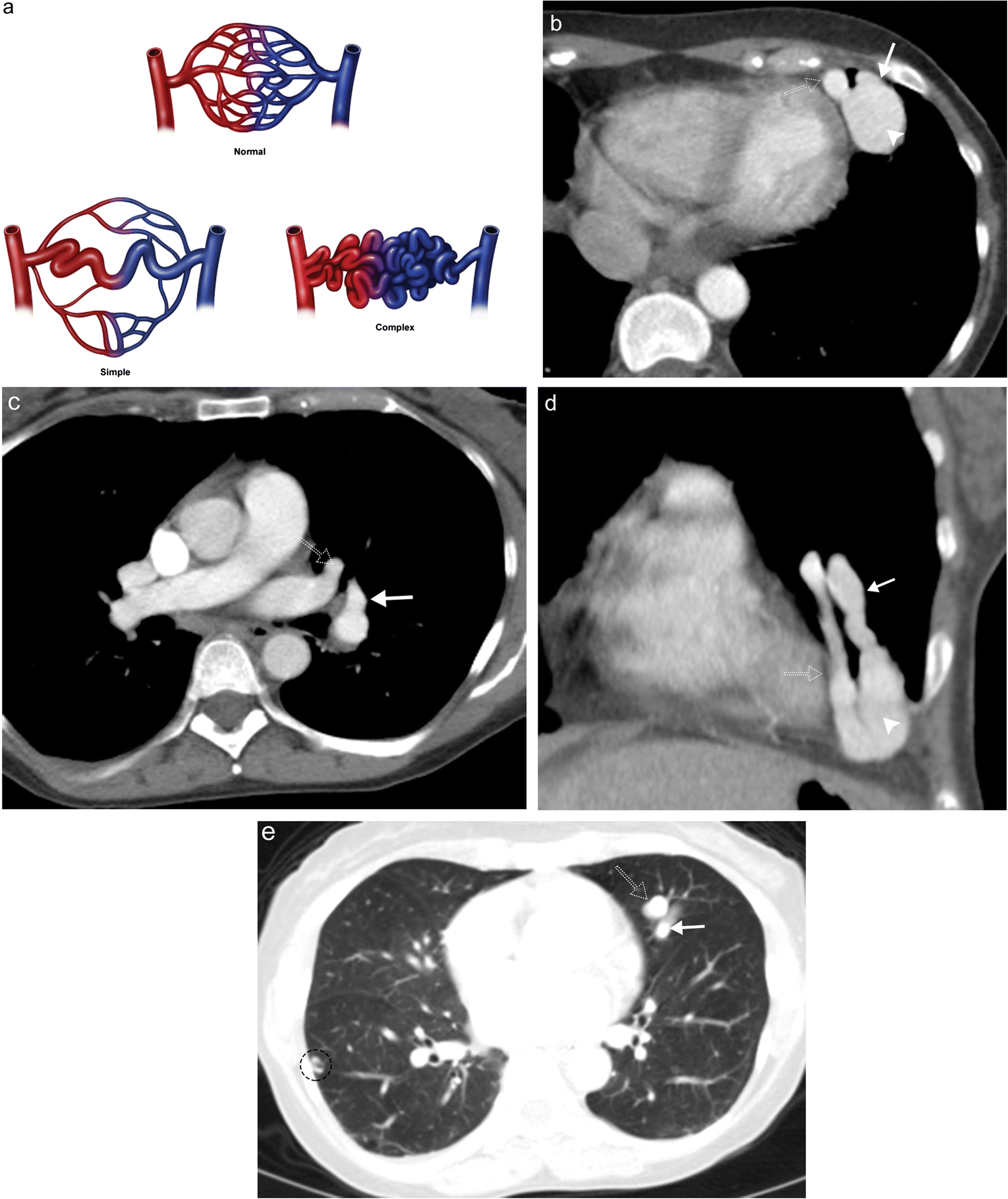 Fig. 17