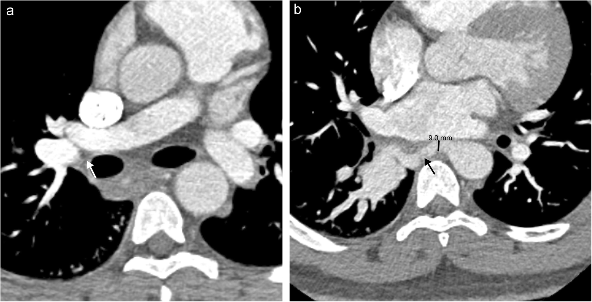 Fig. 20