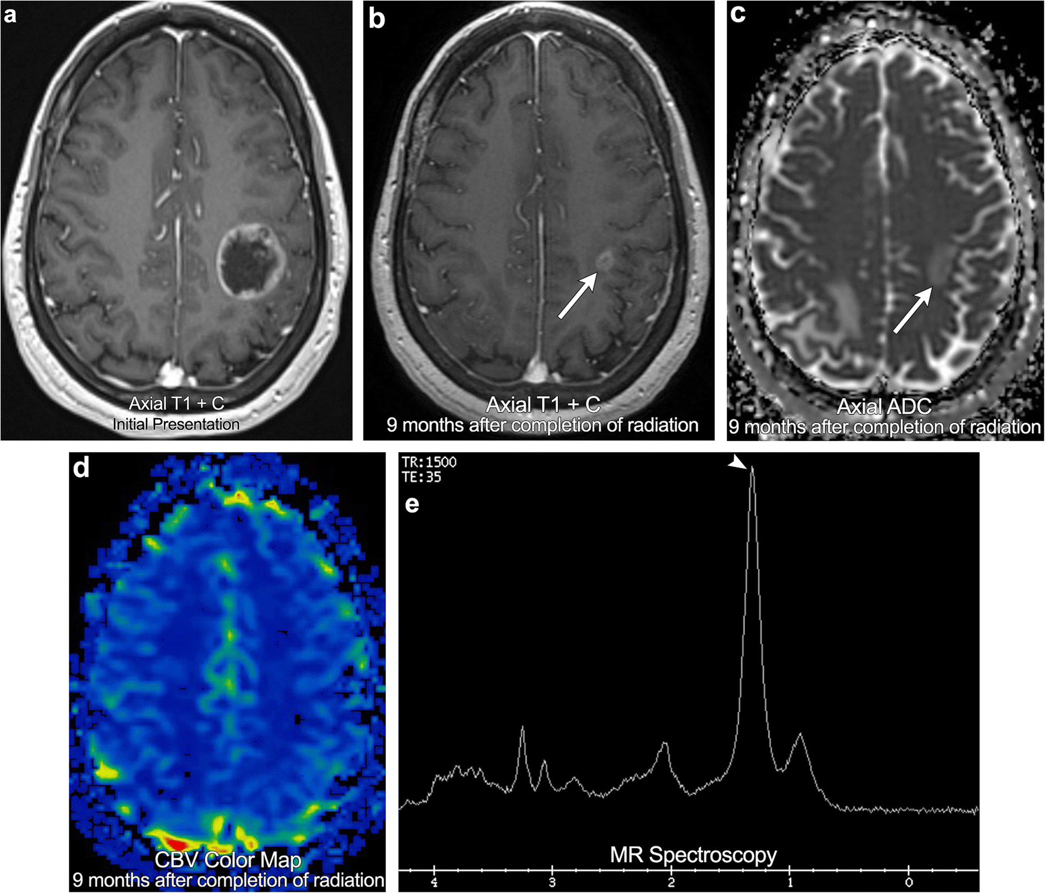 Fig. 10