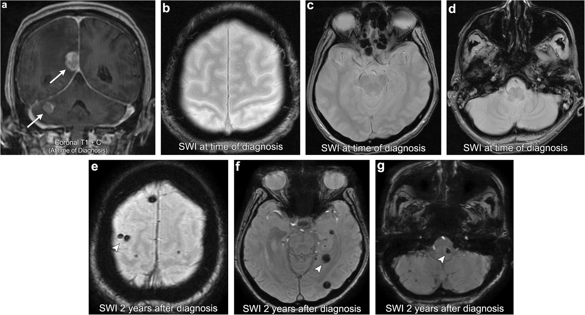 Fig. 12