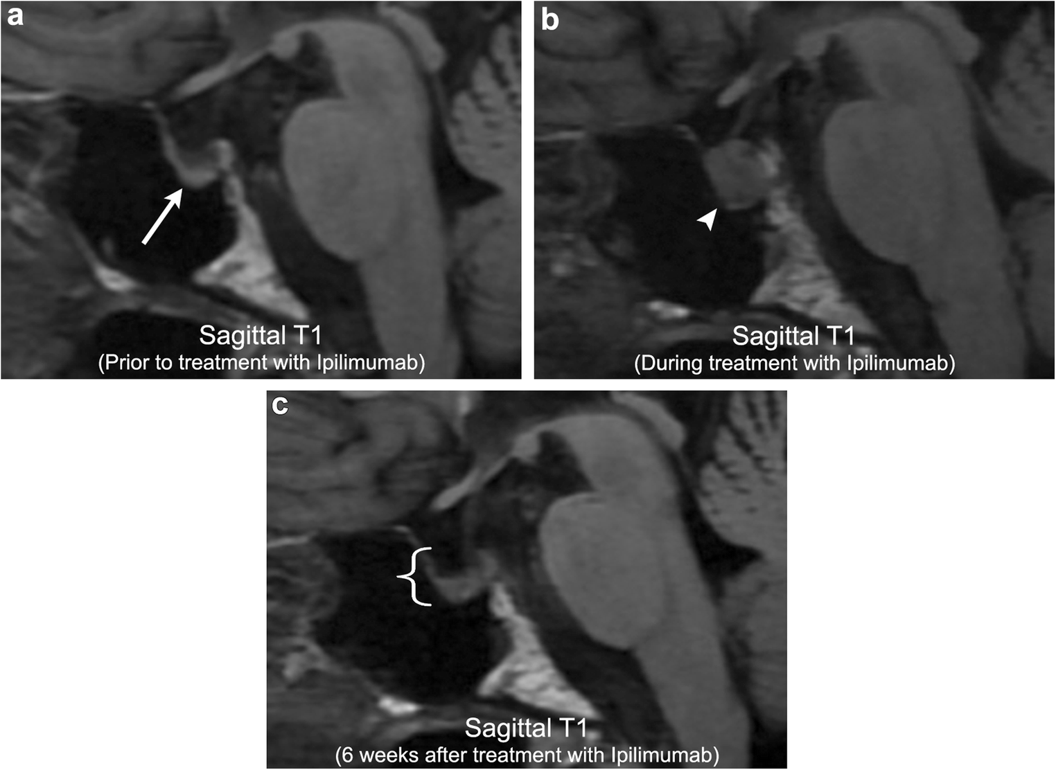 Fig. 16