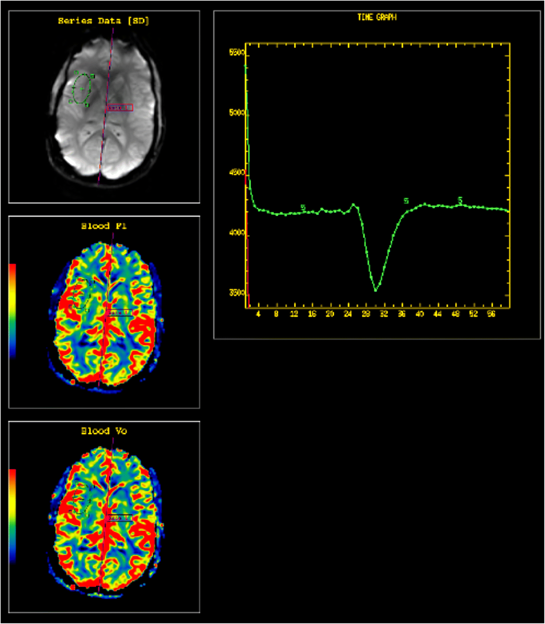 Fig. 3