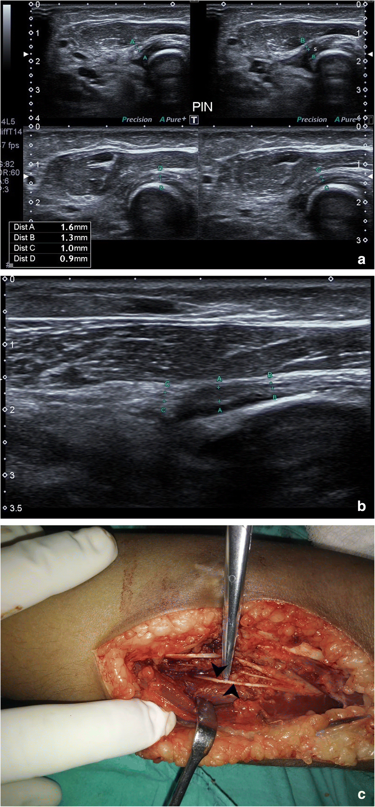 Fig. 7