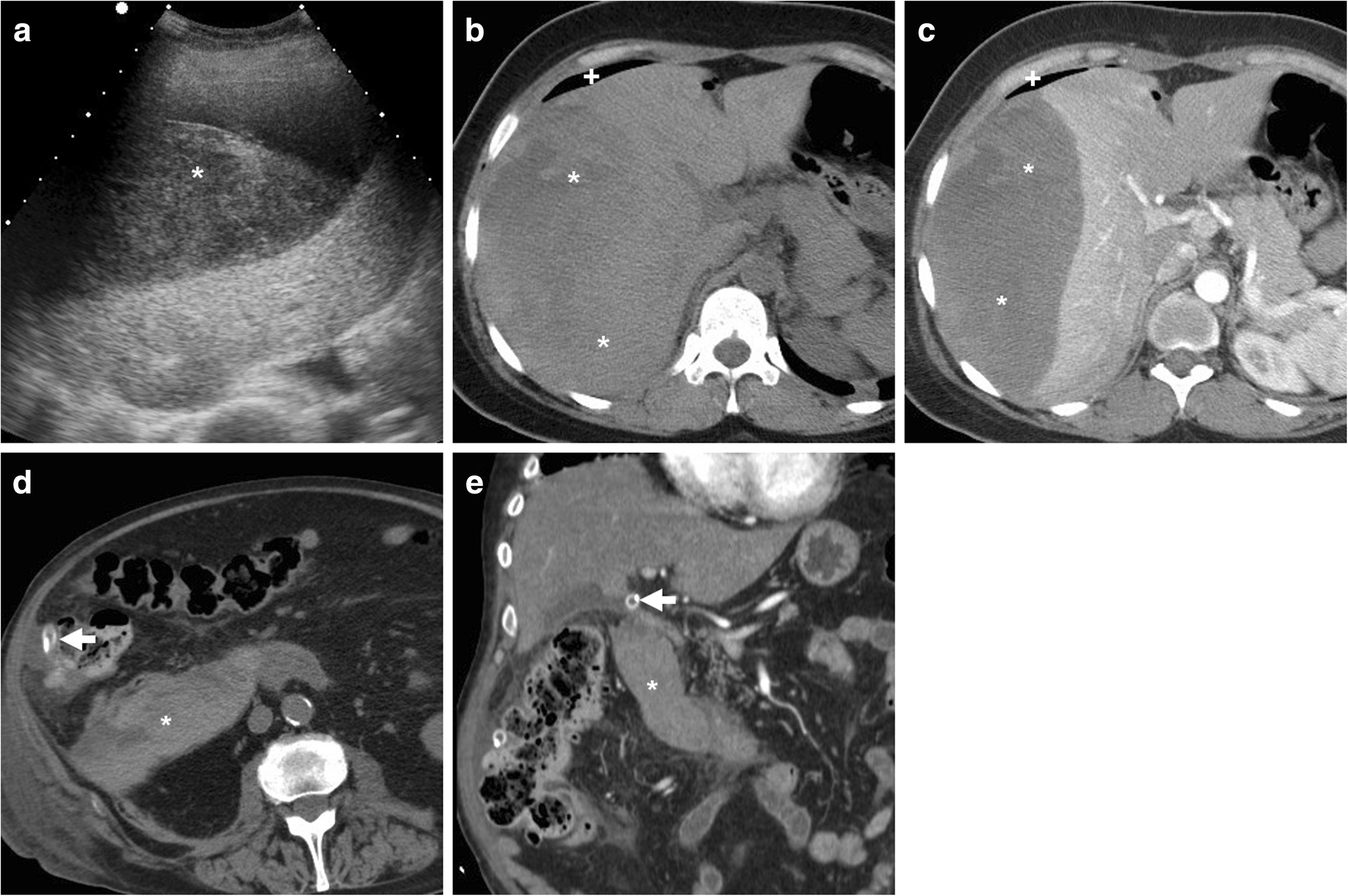 Fig. 13