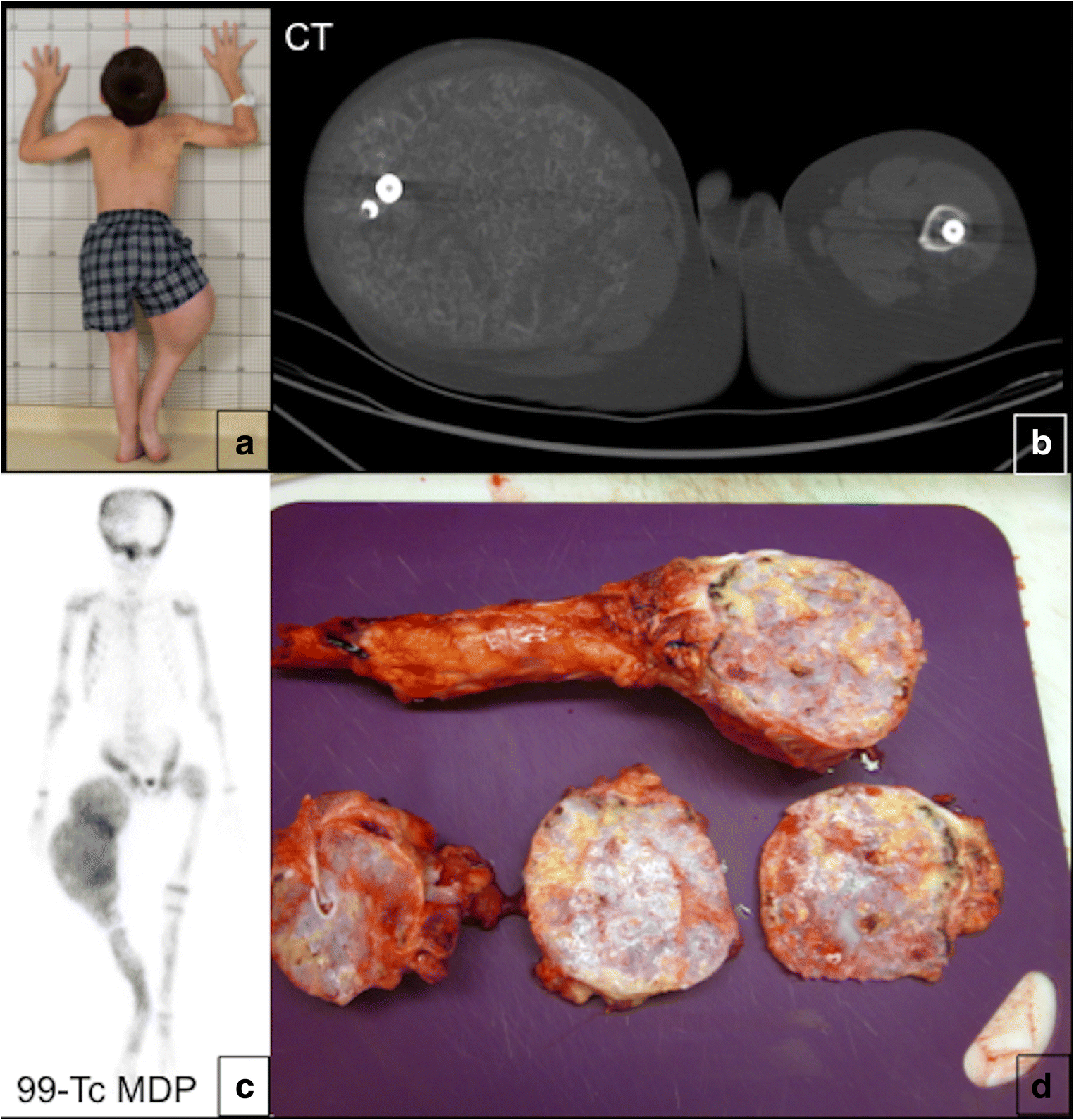 Fig. 17