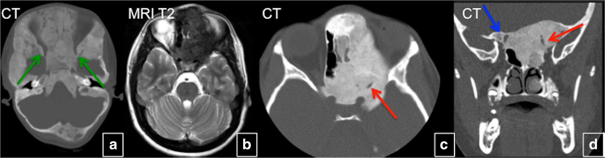 Fig. 19