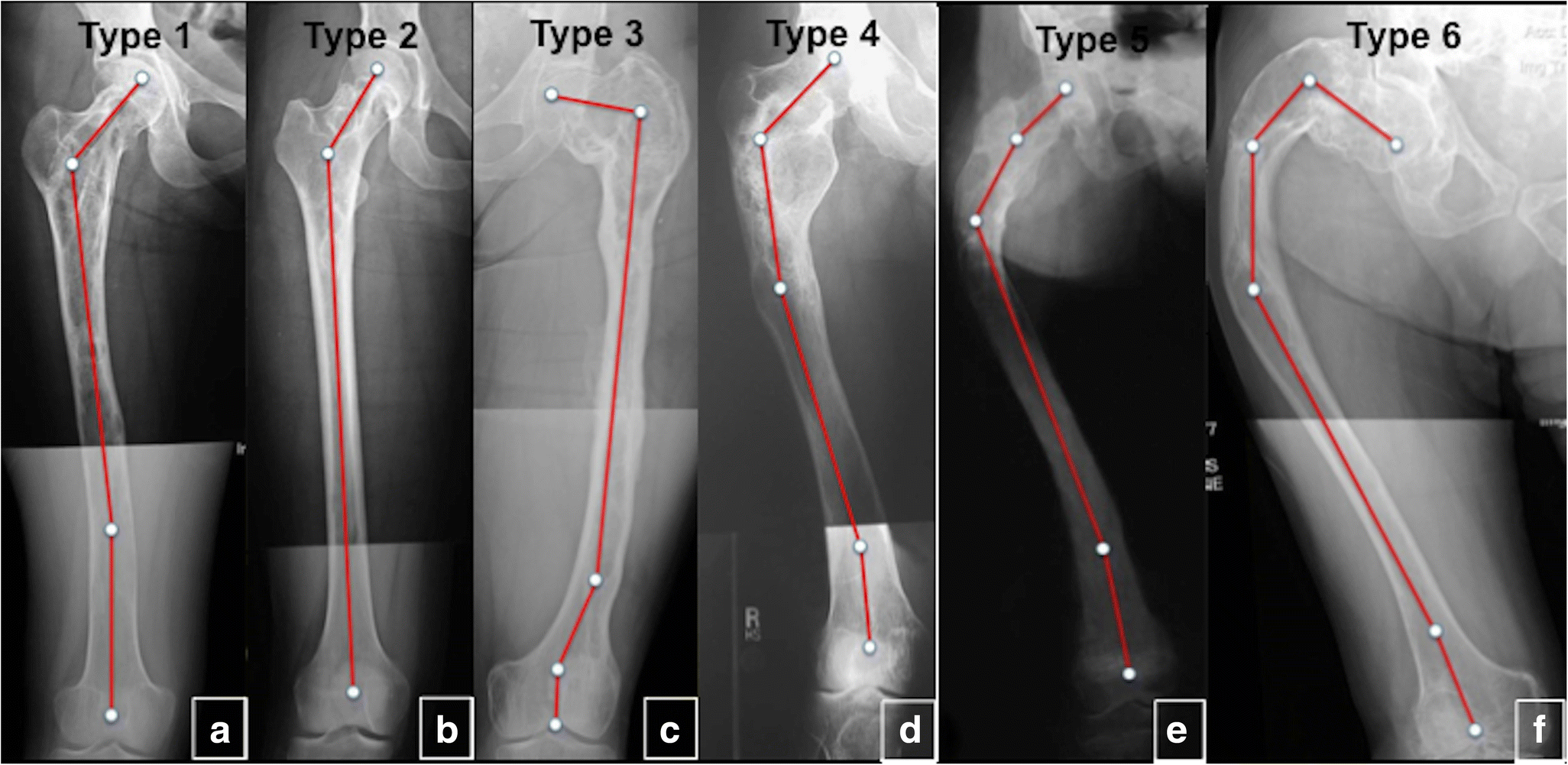 Fig. 23