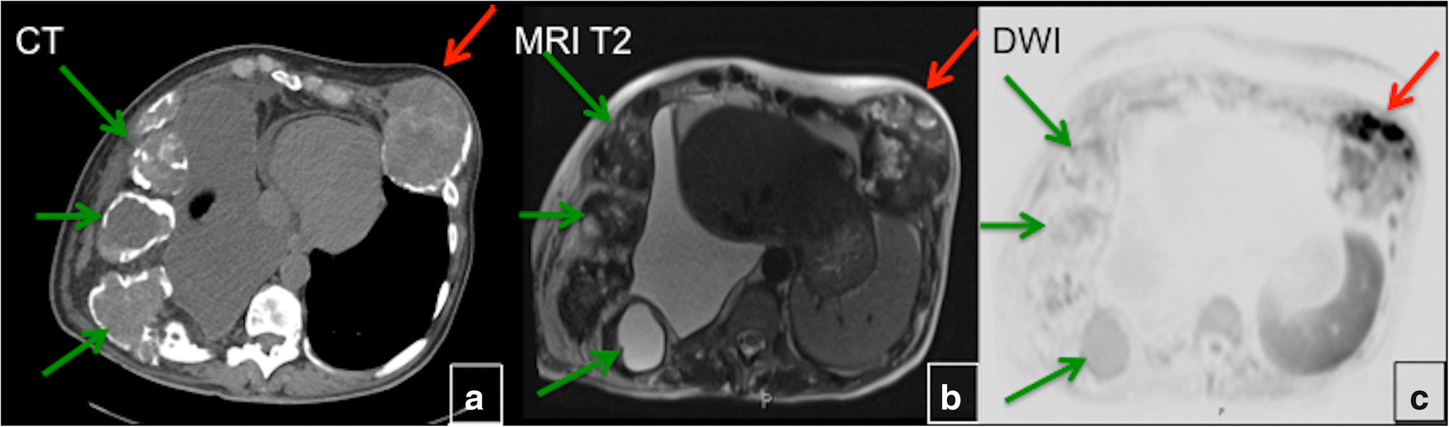 Fig. 9