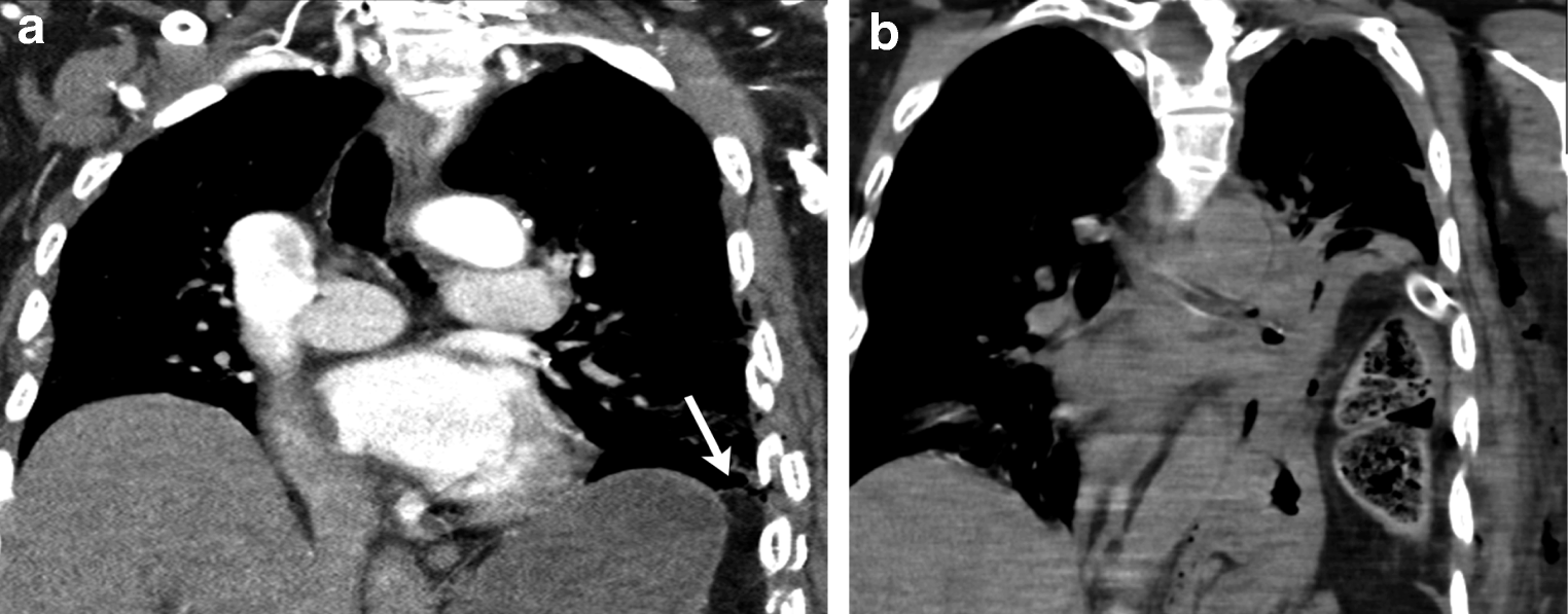 Fig. 17