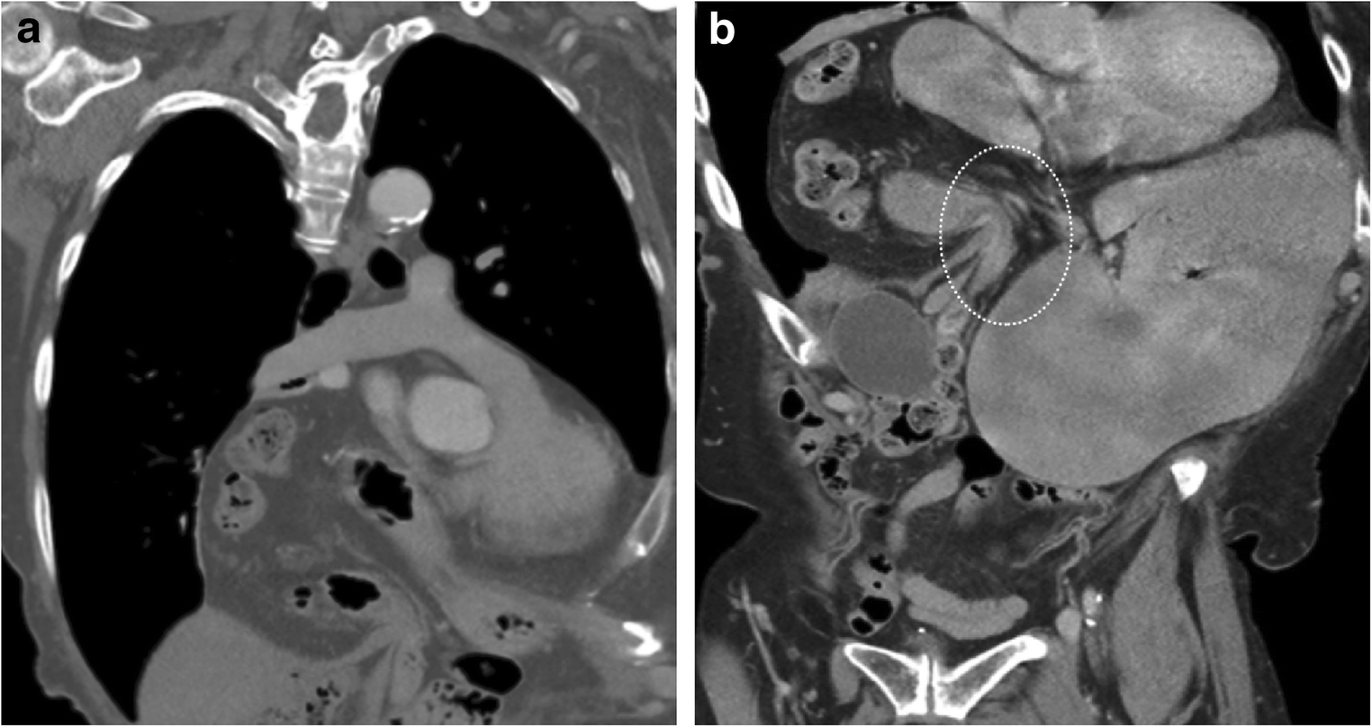 Fig. 21