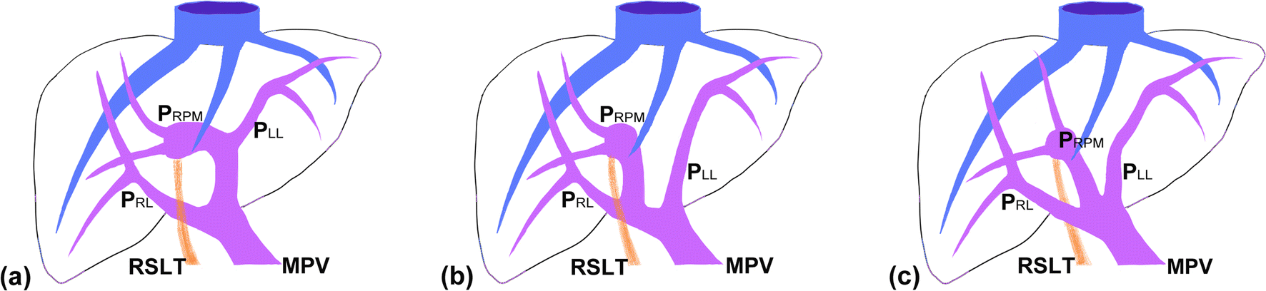 Fig. 11