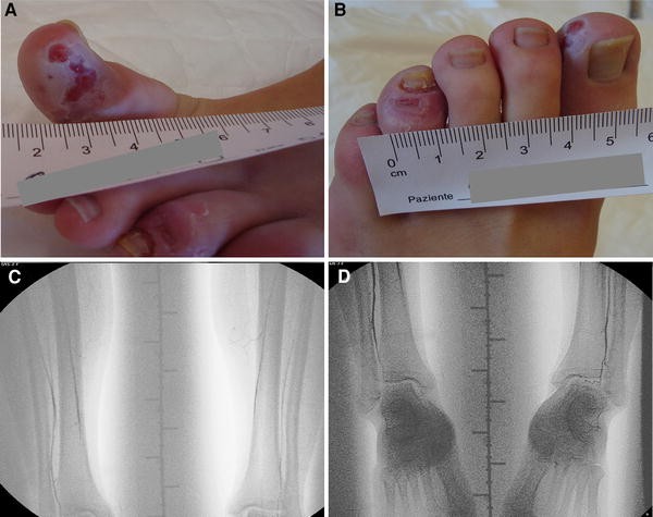 Fig. 1