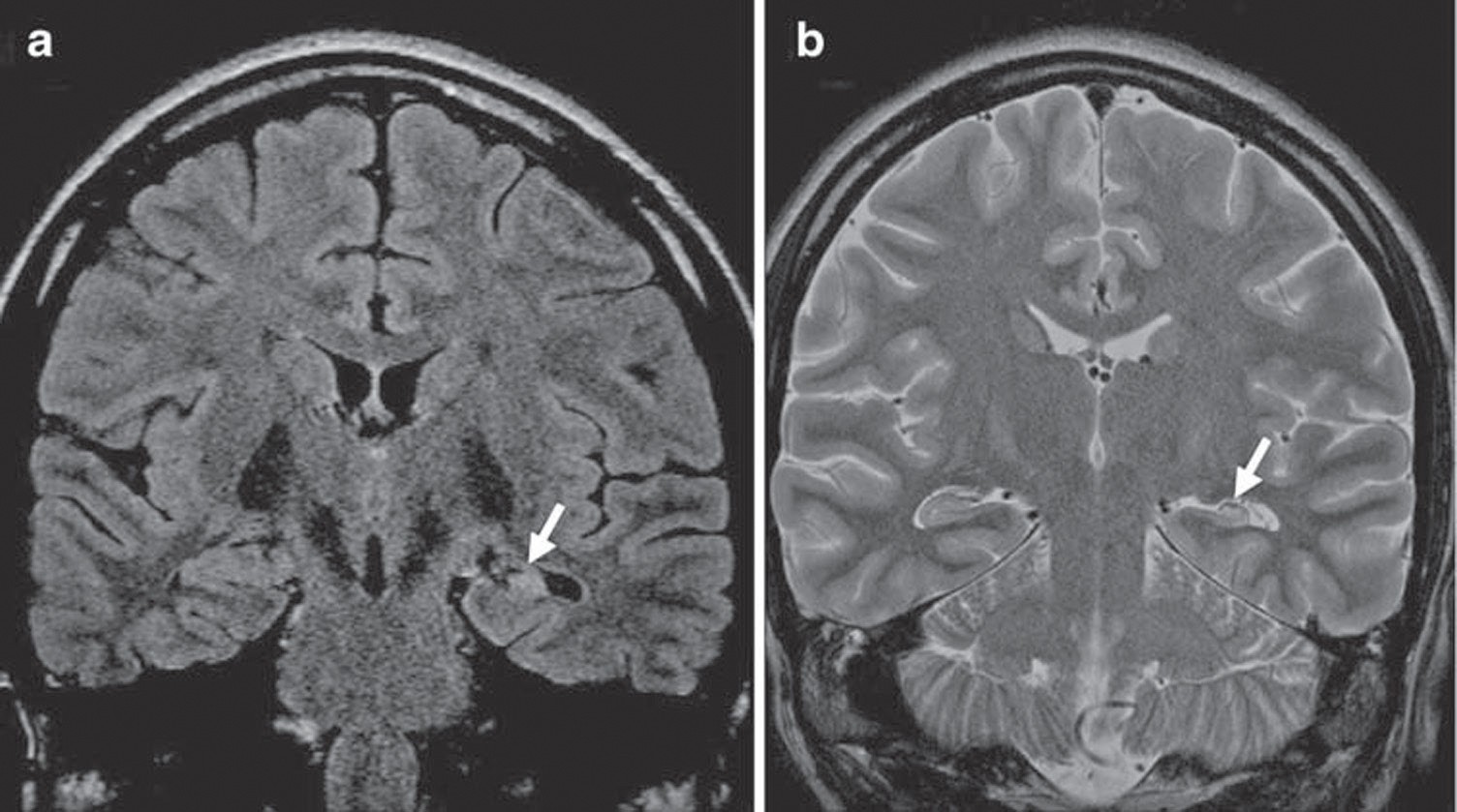 Was Ist Machbar Was Ist Sinnvoll Springerlink