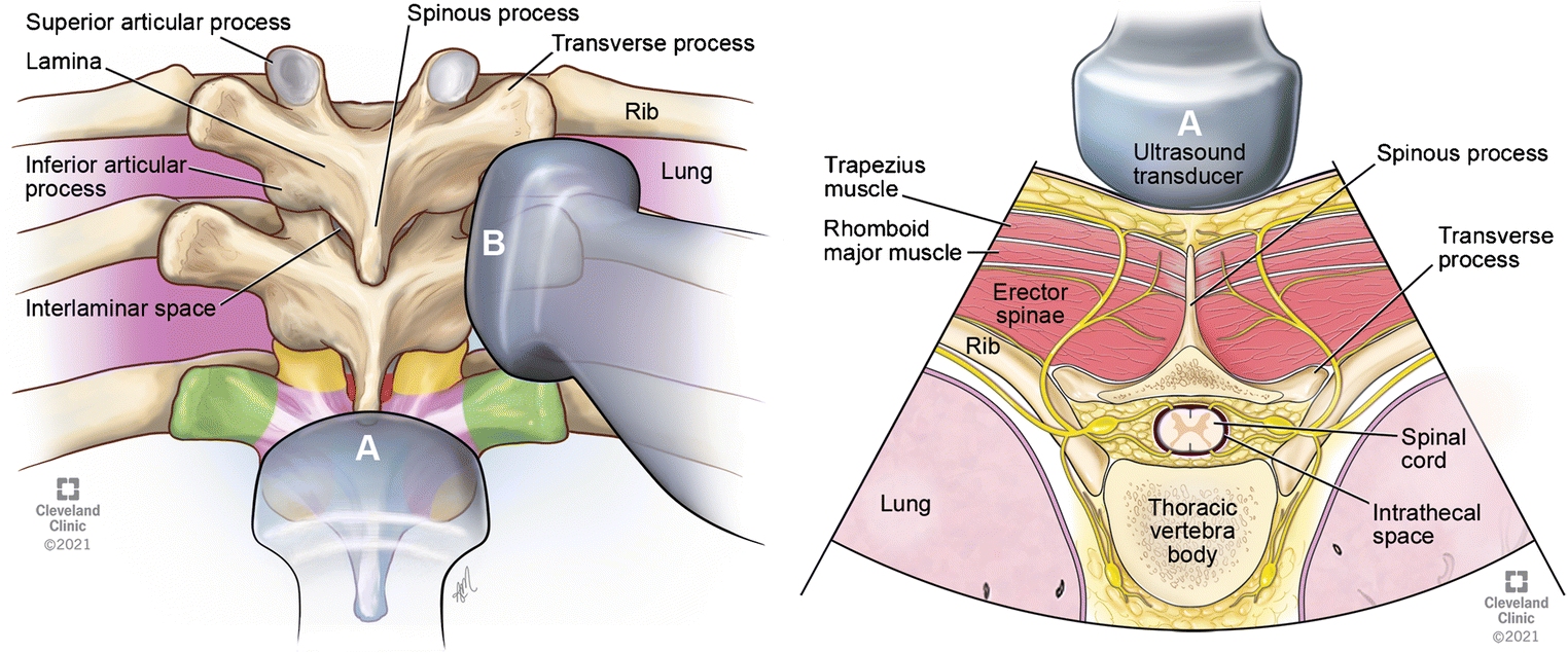 Fig. 19