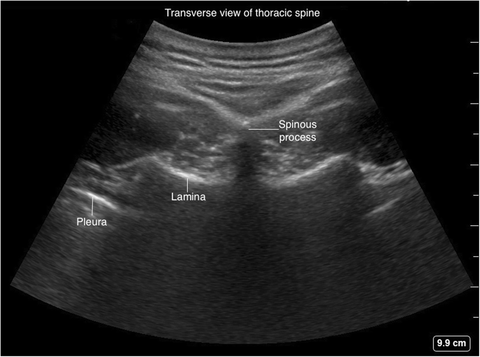 Fig. 24