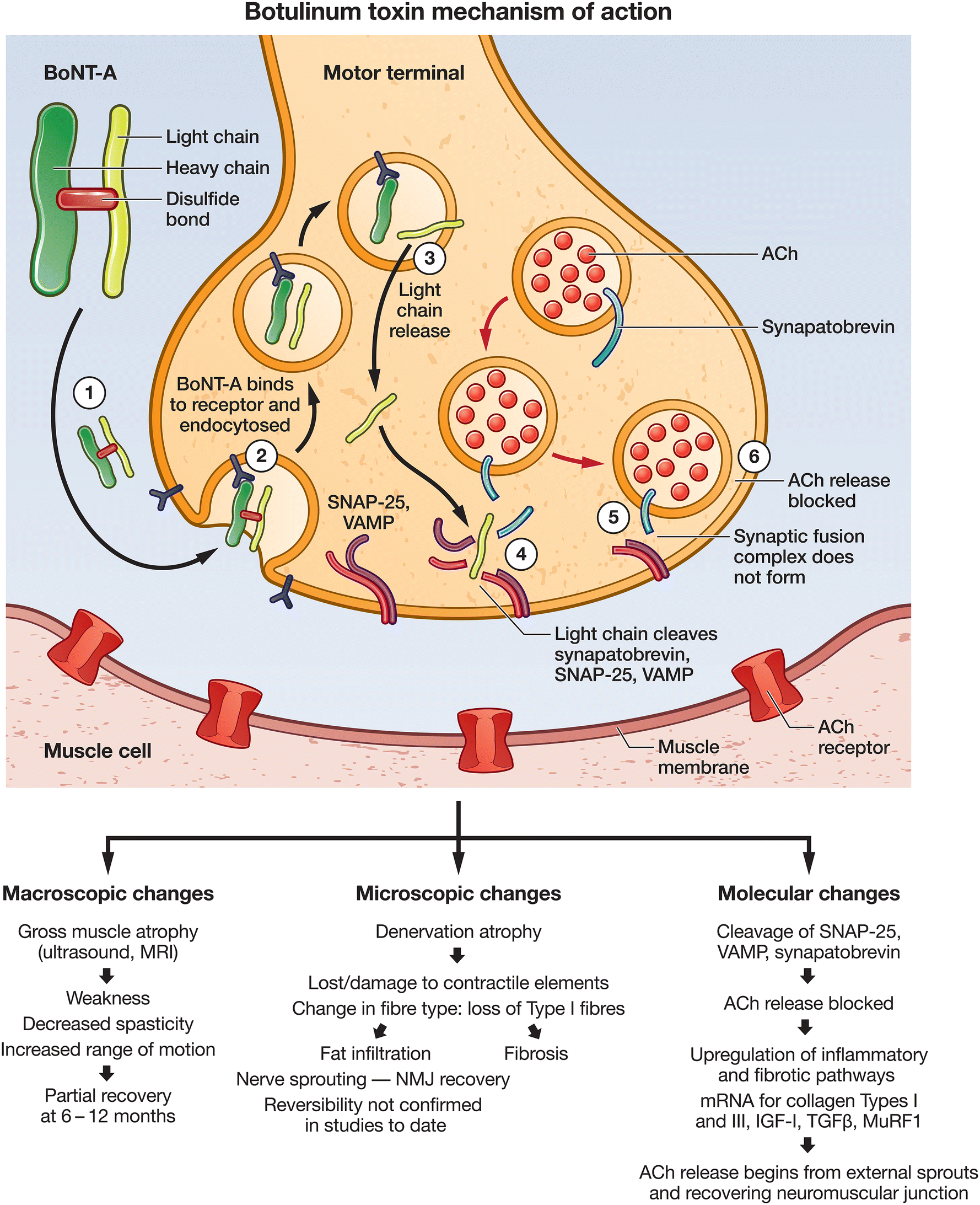 Botulinum toxin – Wikipédia