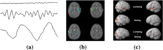 Fig. 1