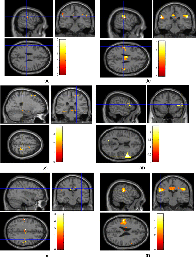 Fig. 12