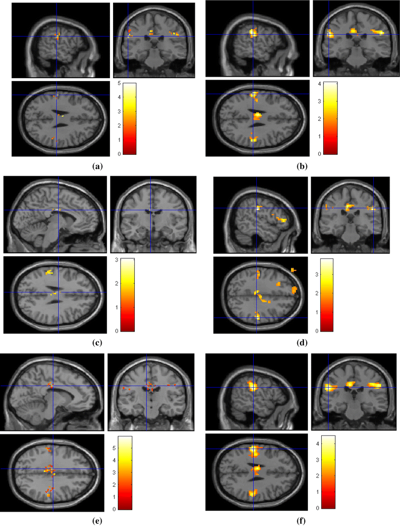 Fig. 13