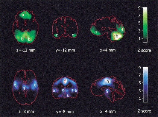 mdma effects on the body