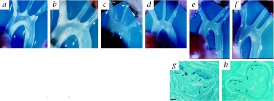 Suppression Of Accelerated Diabetic Atherosclerosis By The Soluble