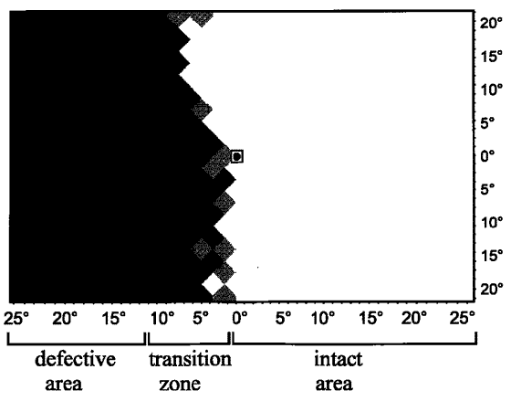 Computer-based training for the treatment of partial blindness 