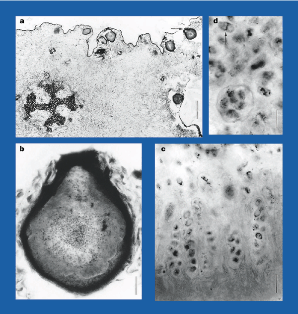 The oldest fossil ascomycetes | Nature