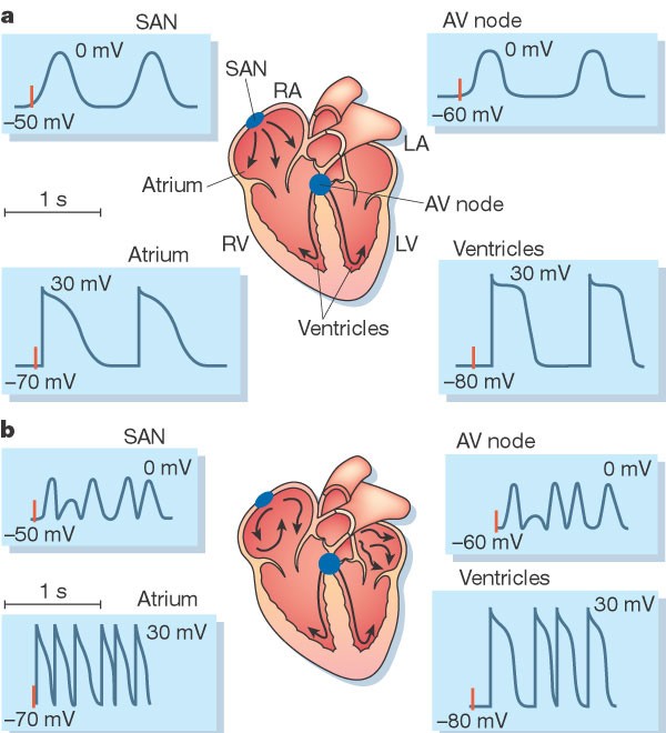 New Ideas About Atrial Fibrillation 50 Years On | Nature