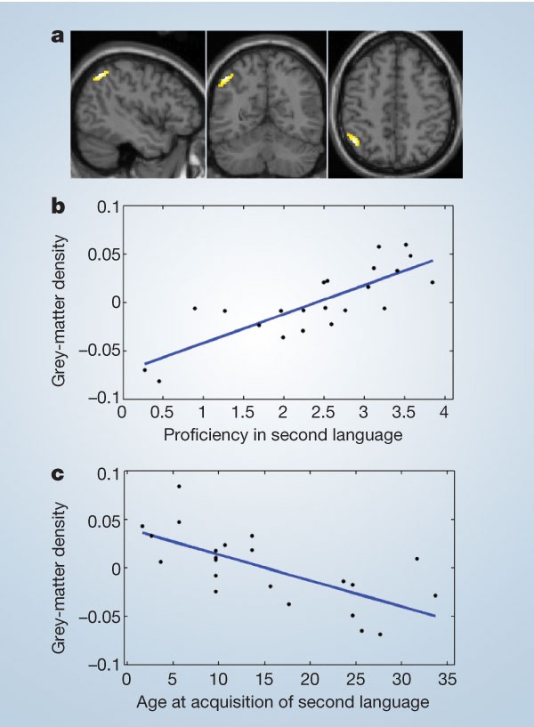 Structural Plasticity In The Bilingual Brain Nature