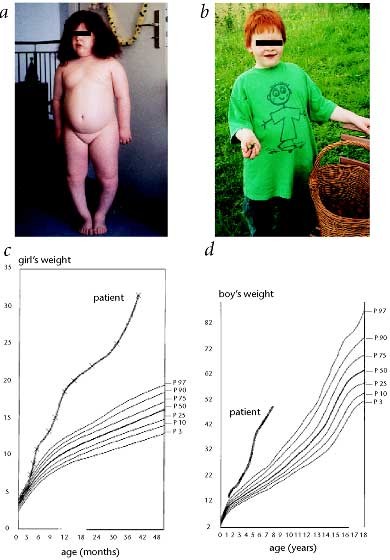 Severe early-onset obesity, adrenal insufficiency and red hair pigmentation caused by POMC mutations in humans | Nature Genetics Severe early-onset obesity, adrenal insufficiency and red hair pigmentation caused by POMC mutations in humans | Nature Genetics