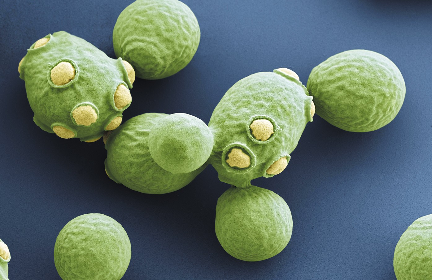 False-color SEM of Saccharomyces cerevisiae yeast cells