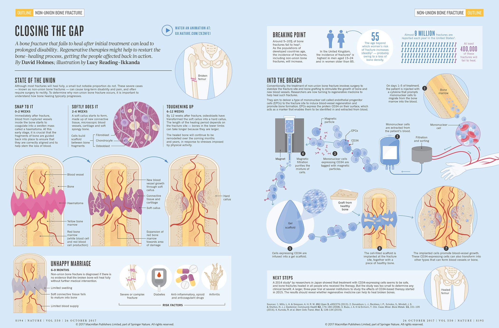 Tough fracture? Help stimulate new bone growth in 30 minutes a day