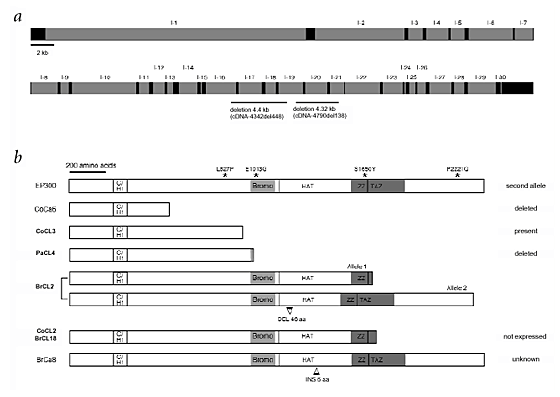 Identification of de novo EP300 and PLAU variants in a patient with  Rubinstein–Taybi syndrome-related arterial vasculopathy and skeletal  anomaly