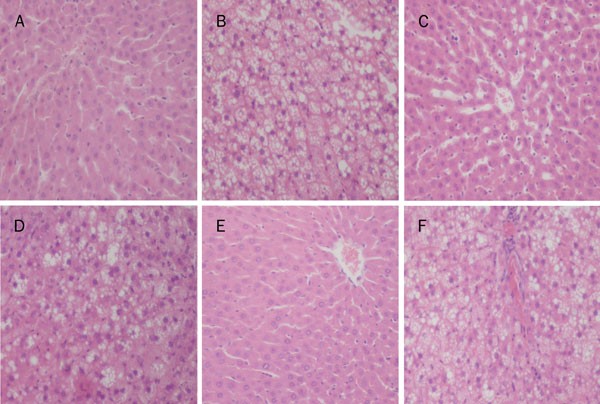 Combined effects of a high-fat diet and chronic valproic acid treatment on  hepatic steatosis and hepatotoxicity in rats | Acta Pharmacologica Sinica