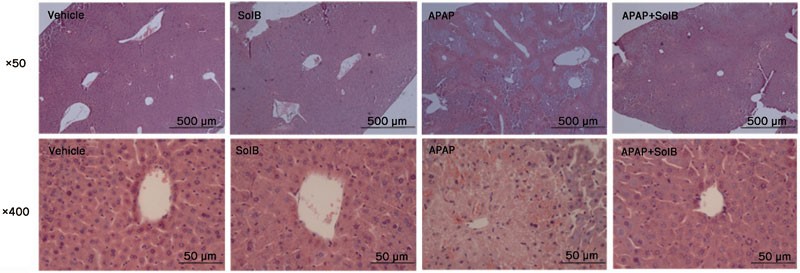 Schisandrol B Protects Against Acetaminophen Induced Acute Hepatotoxicity In Mice Via Activation Of The Nrf2 Are Signaling Pathway Acta Pharmacologica Sinica