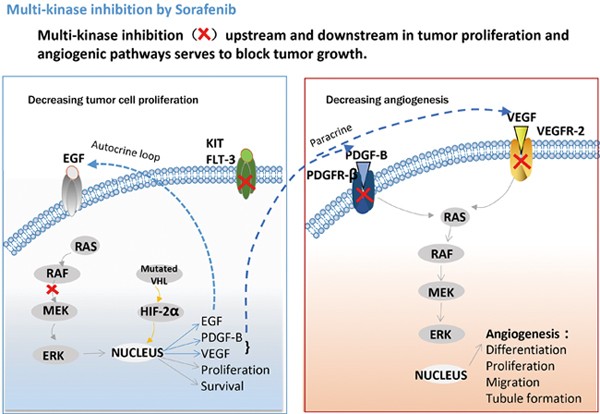 New knowledge of the mechanisms of sorafenib resistance in liver cancer | Acta Pharmacologica Sinica
