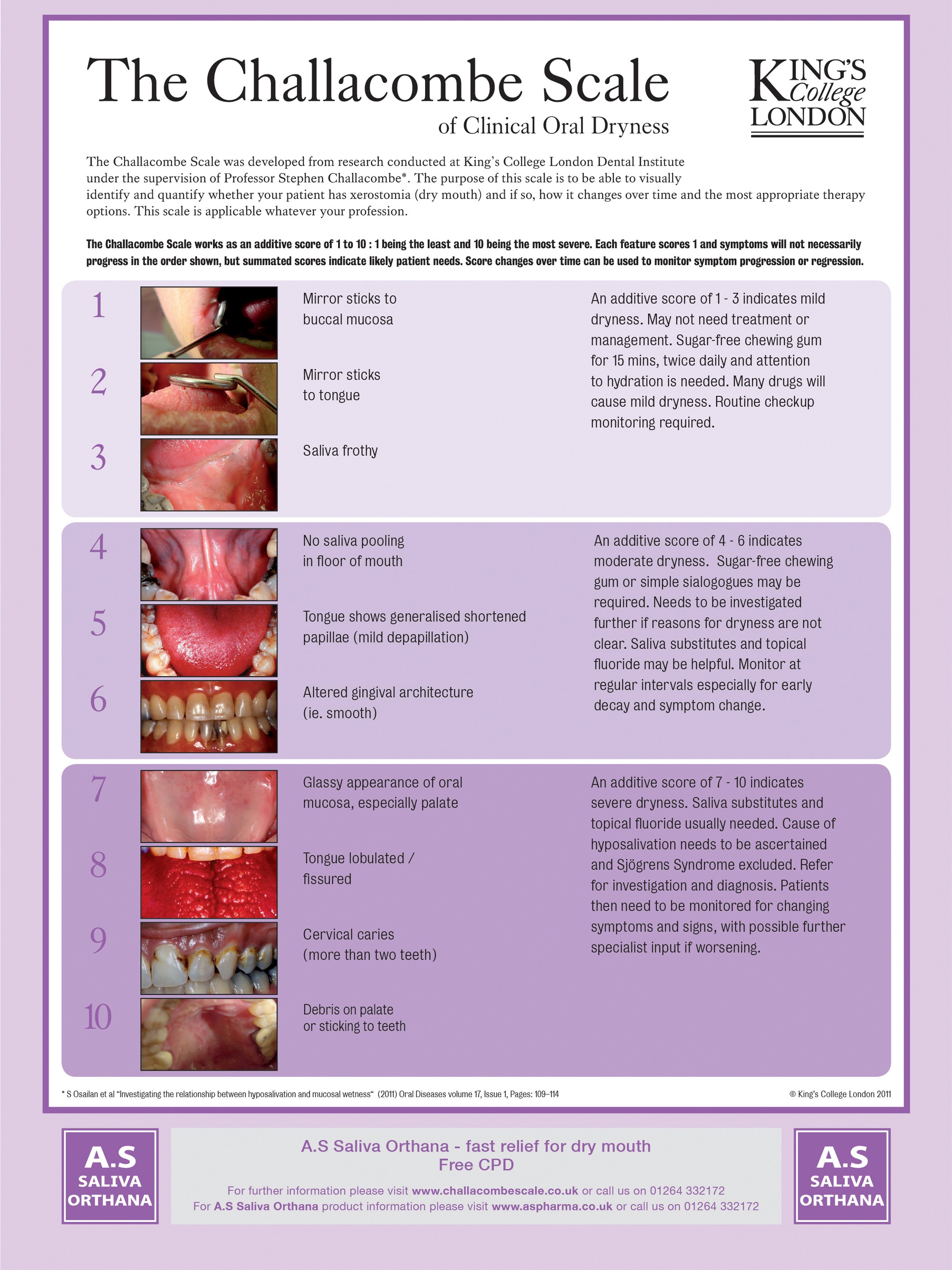 Facilitating Timely Diagnosis Of Sjogren S Syndrome Bdj Team