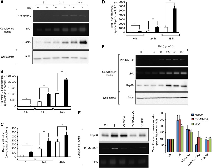 Elastin peptides regulate HT-1080 fibrosarcoma cell migration and invasion  through an Hsp90-dependent mechanism | British Journal of Cancer