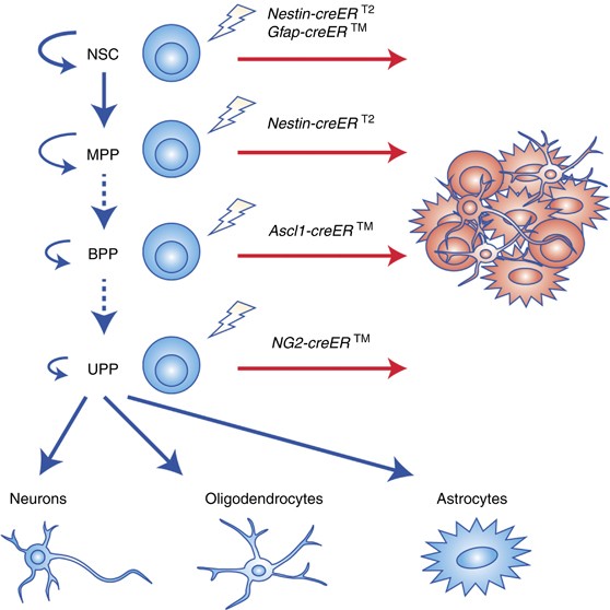 Cell of origin of glioma: biological and clinical implications | British  Journal of Cancer