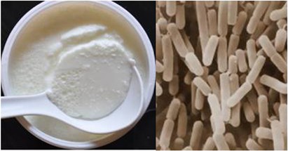 A cautionary tale for probiotic use in hematopoietic SCT patients– Lactobacillus acidophilus sepsis in a patient with mantle cell lymphoma  undergoing hematopoietic SCT | Bone Marrow Transplantation