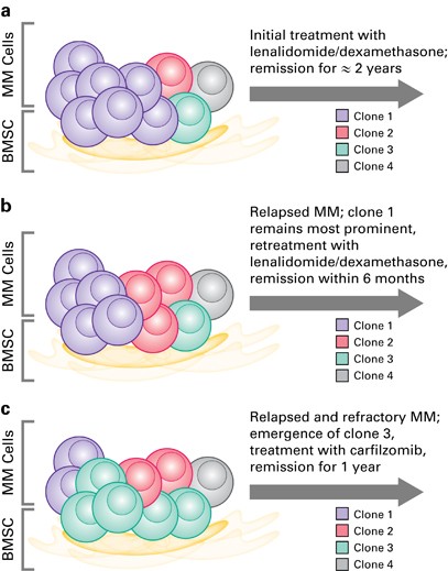 Evolving Paradigms In The Treatment Of Relapsed/Refractory Multiple Myeloma:  Increased Options And Increased Complexity | Bone Marrow Transplantation