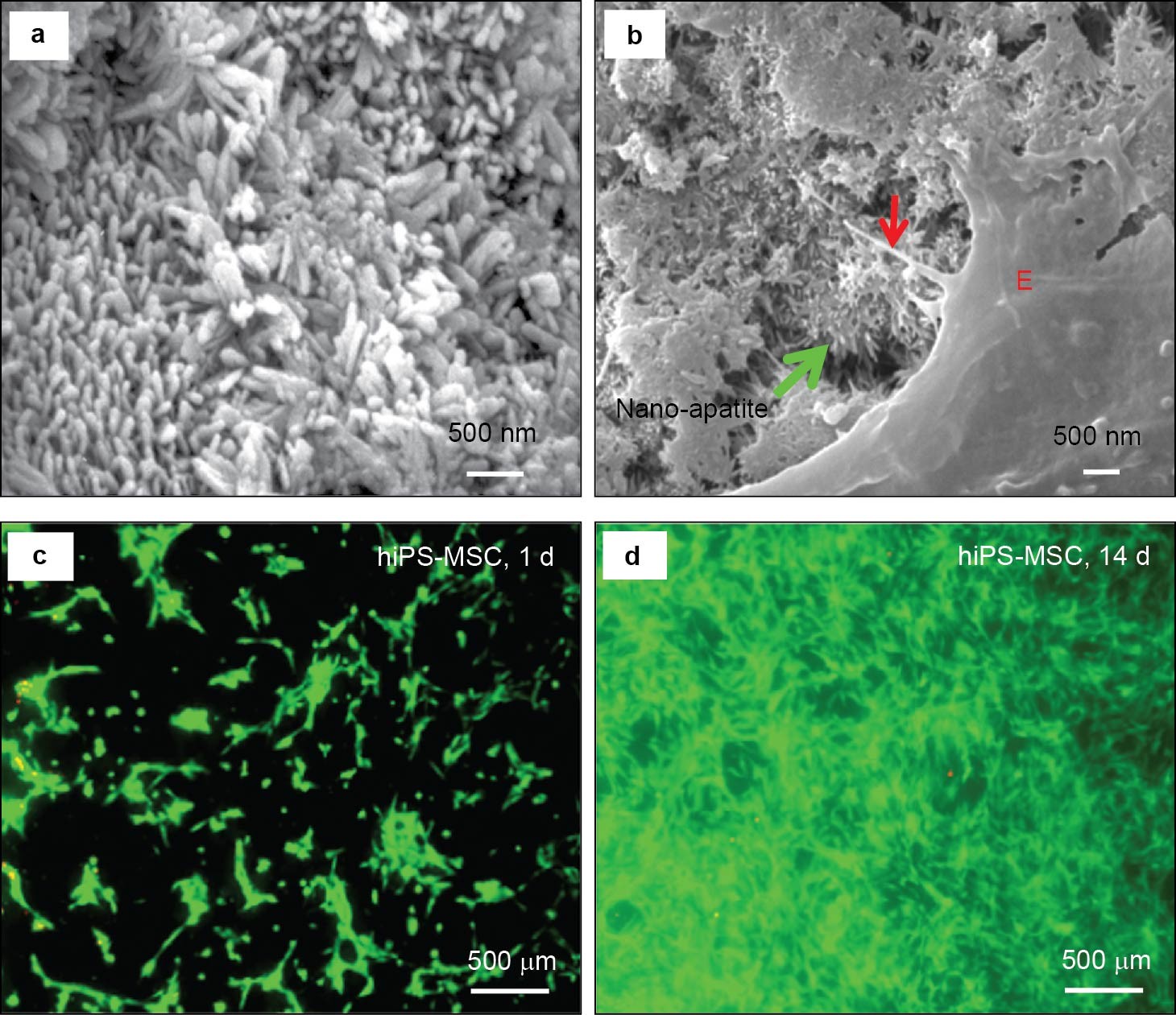 Bone tissue engineering via nanostructured calcium phosphate biomaterials  and stem cells | Bone Research