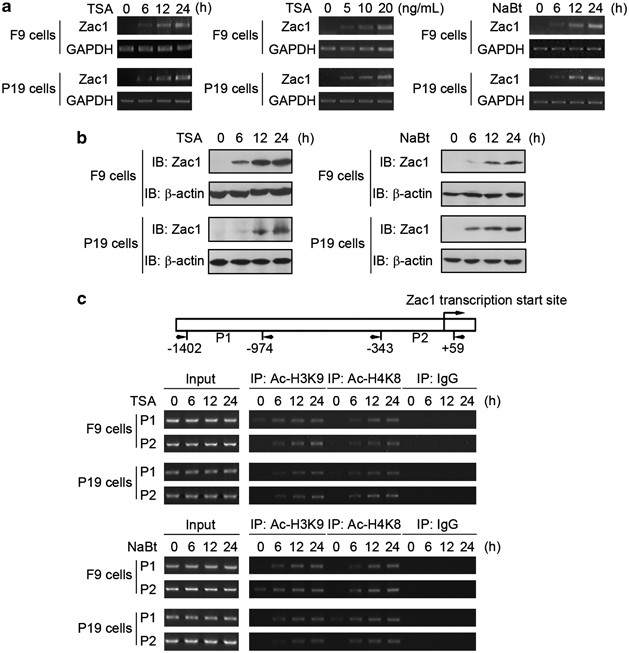 Zac1 is a histone acetylation-regulated NF-κB suppressor that mediates  histone deacetylase inhibitor-induced apoptosis | Cell Death &  Differentiation