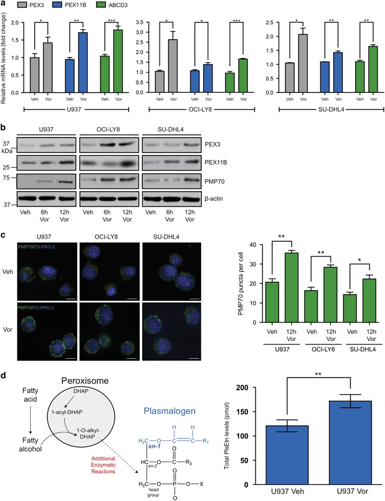 Peroxisomes protect lymphoma cells from HDAC inhibitor-mediated apoptosis |  Cell Death & Differentiation