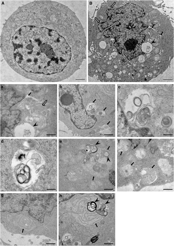 Loss Of Function Of The Als Protein Sigr1 Leads To Er Pathology Associated With Defective Autophagy And Lipid Raft Disturbances Cell Death Disease