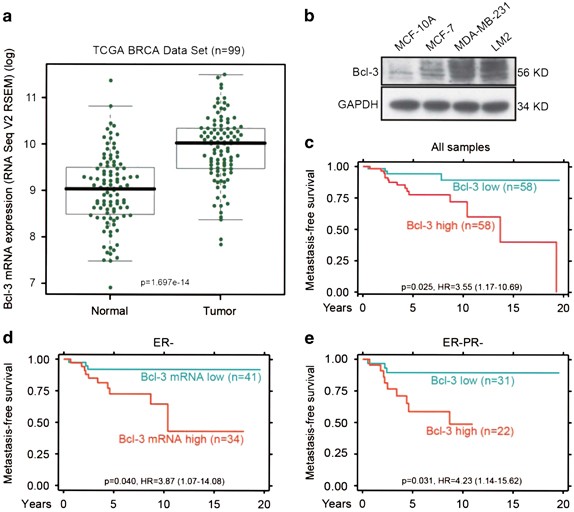 Bcl-3 regulates TGFβ signaling by stabilizing Smad3 during breast cancer  pulmonary metastasis | Cell Death & Disease