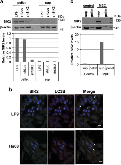 Activation Of Salt Inducible Kinase 2 Promotes The Viability Of Peritoneal Mesothelial Cells Exposed To Stress Of Peritoneal Dialysis Cell Death Disease